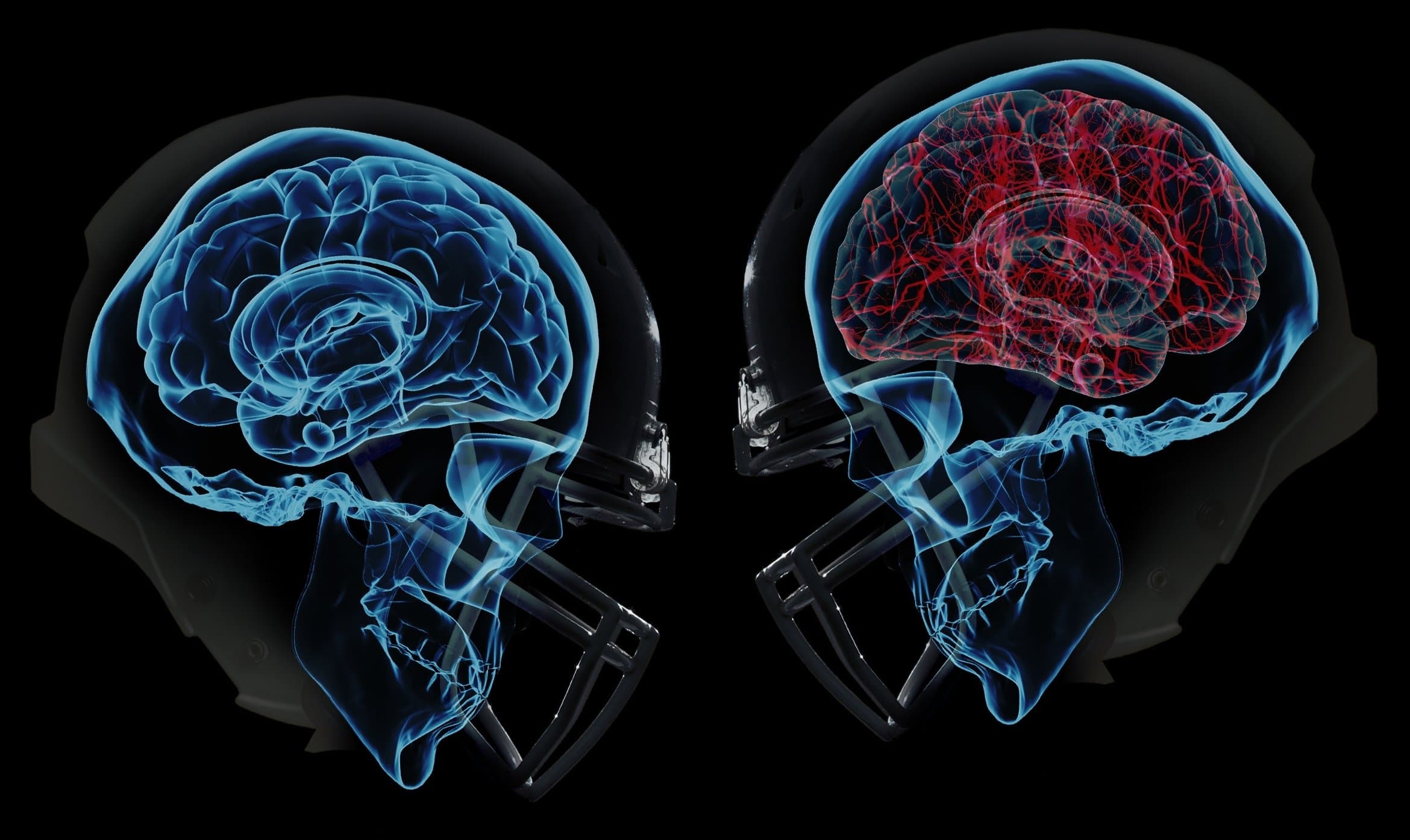 manual-therapy-treatment-for-concussions